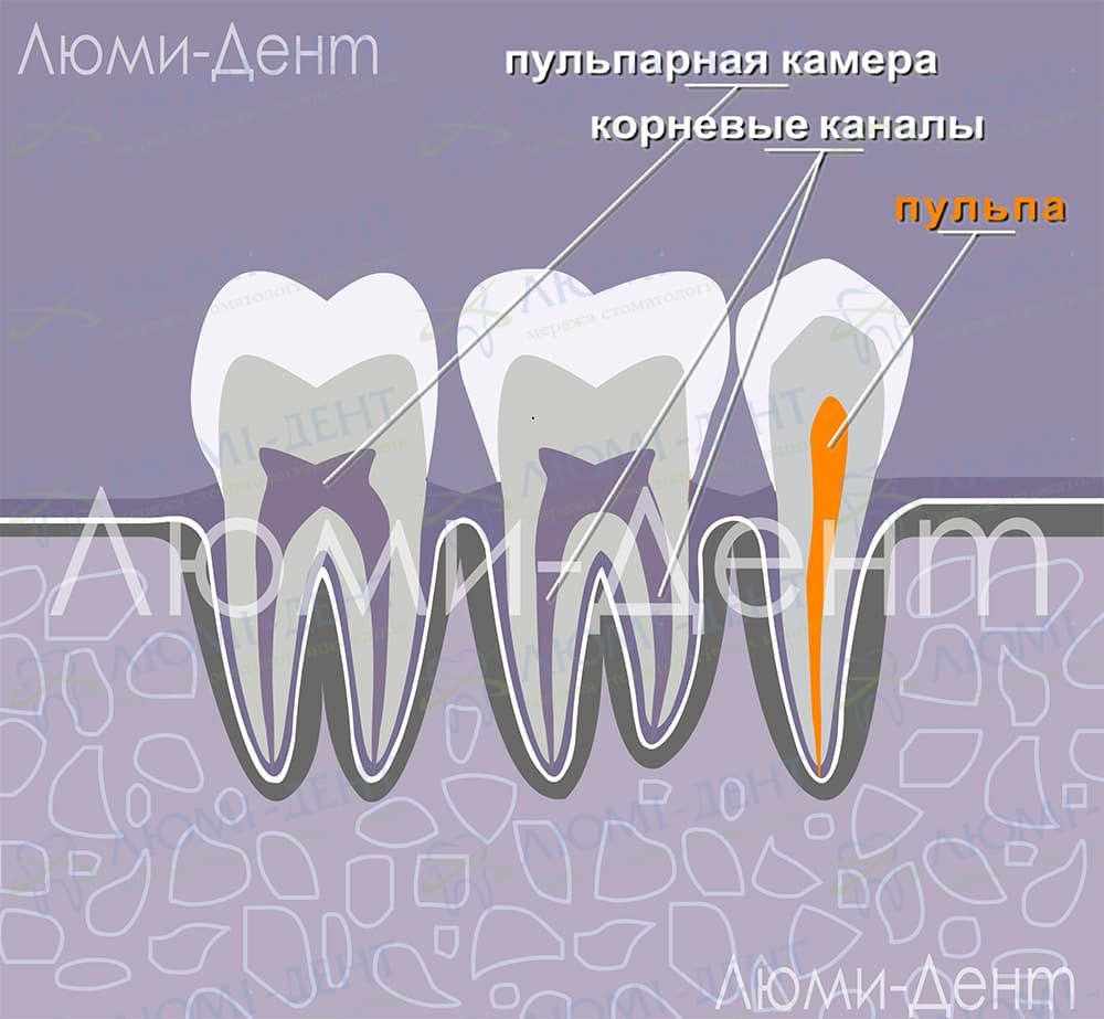 Если болит зуб: как убить нерв в домашних условиях и стоит ли это делать